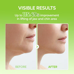 CACTOX V-LIFTING MEWING BAND with Cactus Cooling Reduce Puffiness & Pore Tightening for Visible Pore Care Skin Repair