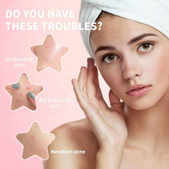 Pimple Patches for Face, Hydrocolloid Acne Patches, Cute Star Stickers for Covering Zits and Blemishes (200 Count)