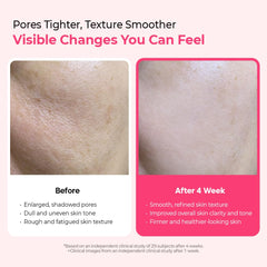 Cyano Pink Spicule Serum with Vitamin B12, Liquid Microneedle Facial Treatment for Enlarged Pores, Niacinamide for Texture Refining & Renewal, 1.01 fl.oz