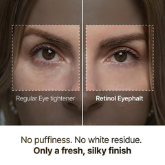 Retinol Eyebag Cream for Puffiness, Dark Circles & Fine Lines, Wrinkle, EGF Anti-Aging Under Eye Moisturizer with Niacinamide&Ceramide korean skin care