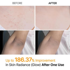 Body Keratin Care Kojic Acid Turmeric Spray Gently Exfoliating Peeling Solution Korean Skincare All Skin Types 200ml