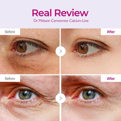 Firming Collagen Eye Patch Calcium Volume Under Eye Patches for Puffy Eyes & Dark Circles, Hydrogel Eye Mask for Wrinkles, Fine Lines & Sagging Skin, Korean Skin Care (60 Count)