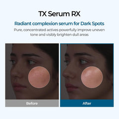 TX ampoule RX facial ampoule 30ml Rx (K-Beauty )Reduce Wrinkles, Dark Spots