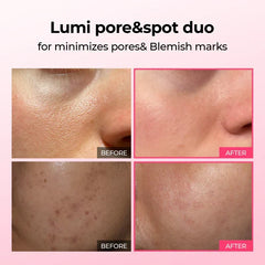 Lumi Pore & Spot Care Duo